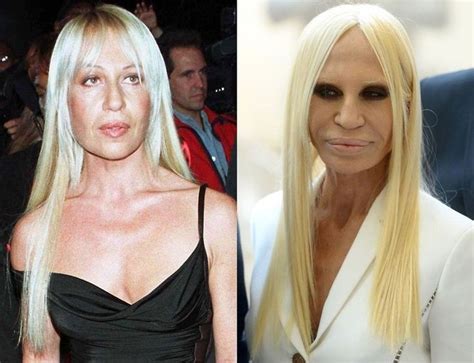 duna stella versace|donatella versace before plastic surgery.